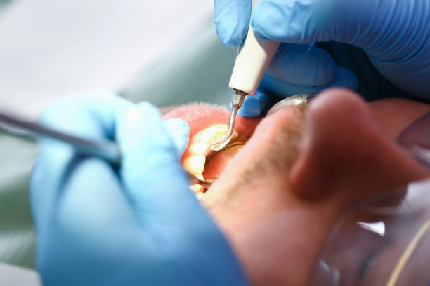 Best Urgent Dental Care in Algonquin, IL